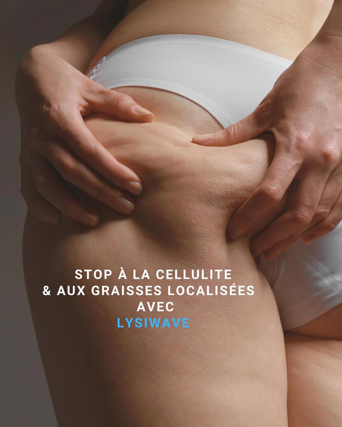Traitement Cellulite Lysiwave | Centre de Laser l’Étoile La Ciotat