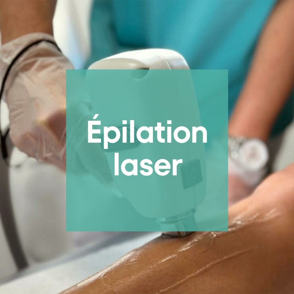 Epilation Laser Définitive | Centre de Laser l’Étoile La Ciotat