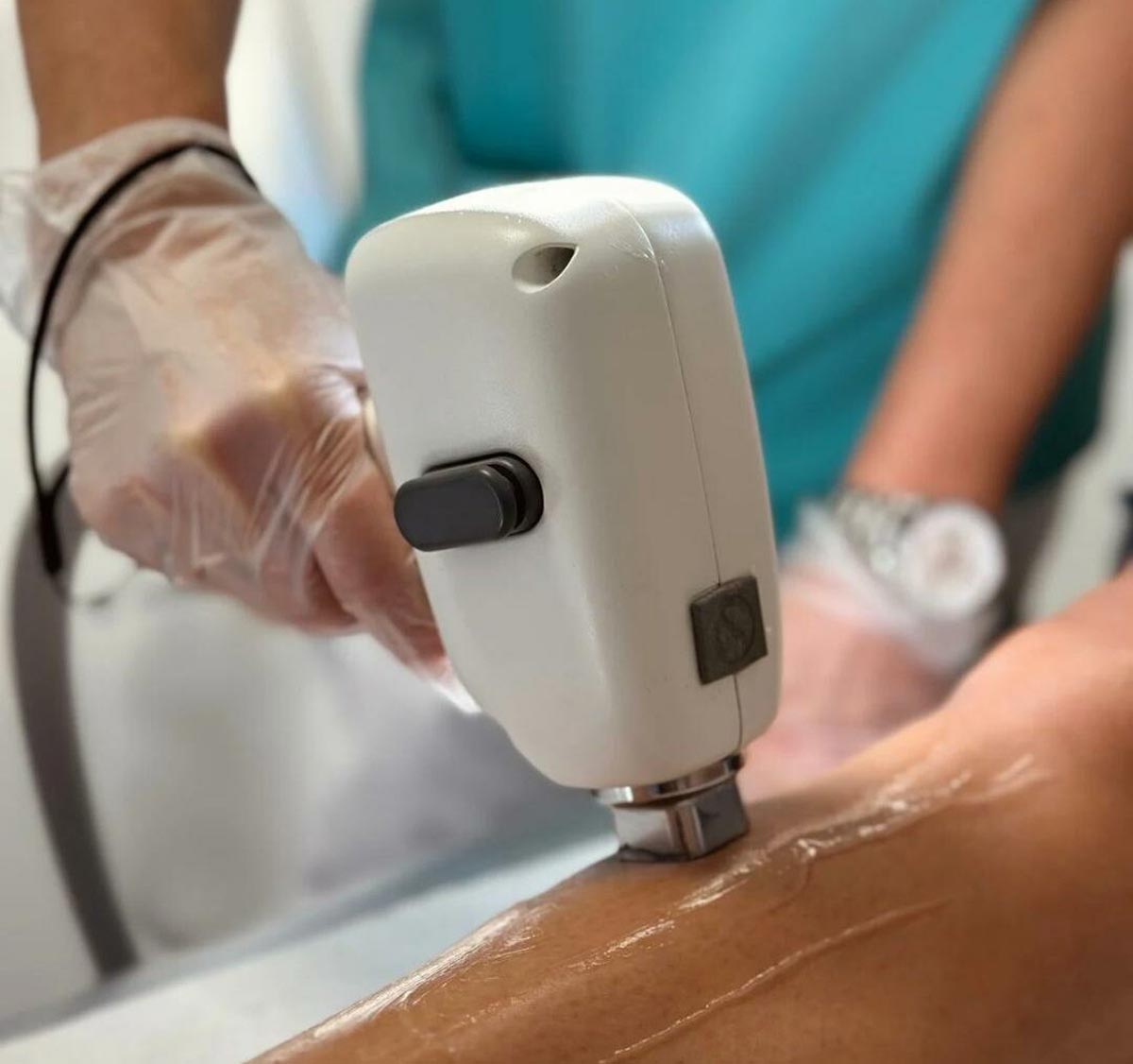Epilation au laser | Centre de Laser l’Étoile La Ciotat