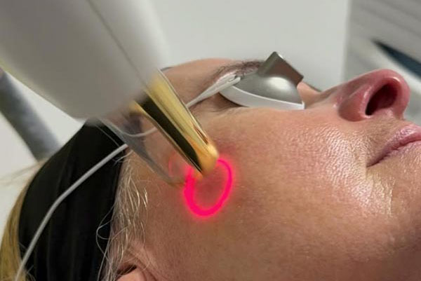 Traitement Anti-Rides | Centre de Laser l’Étoile La Ciotat